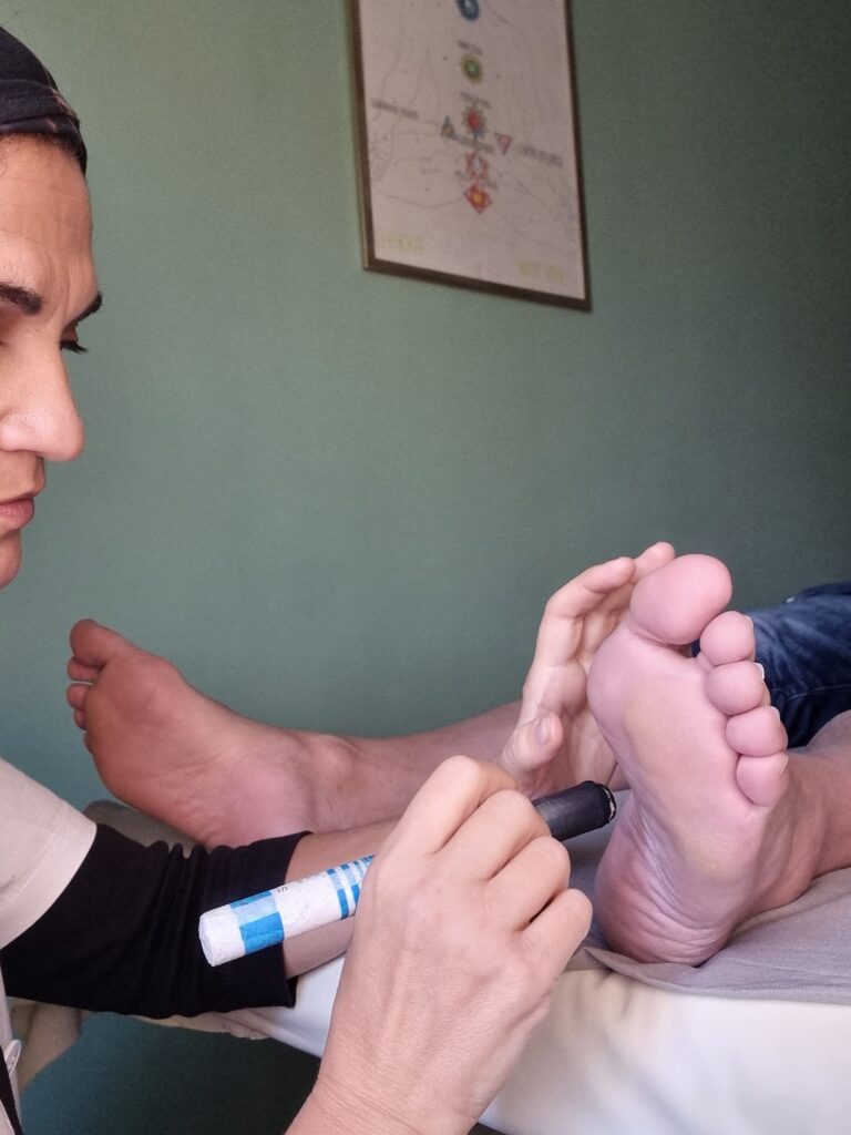 Moxa moxibustione torino riflessologia plantare zu